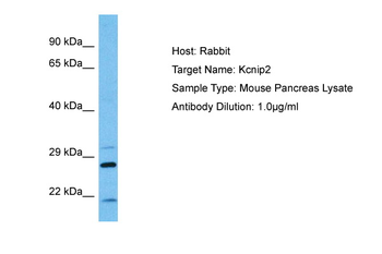 KCNIP2 Rabbit Polyclonal Antibody