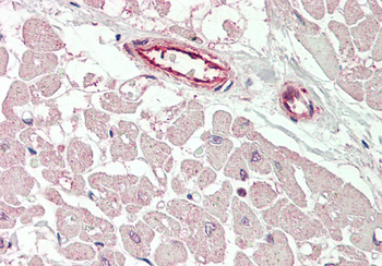 KCNIP2 Rabbit Polyclonal Antibody