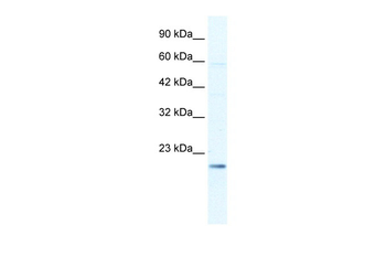 KCNIP2 Rabbit Polyclonal Antibody