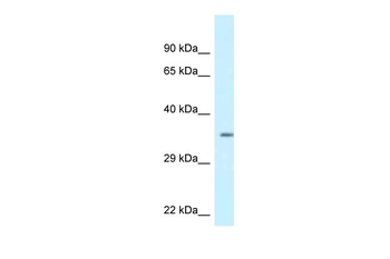KCNIP2 Rabbit Polyclonal Antibody
