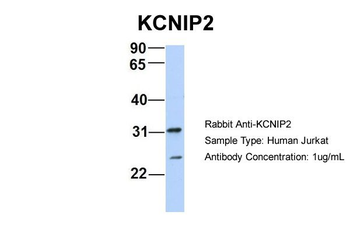 KCNIP2 Rabbit Polyclonal Antibody