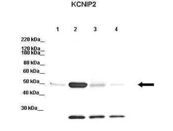 KCNIP2 Rabbit Polyclonal Antibody