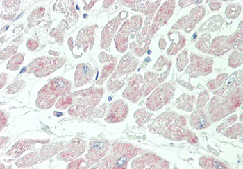 KCNIP2 Rabbit Polyclonal Antibody