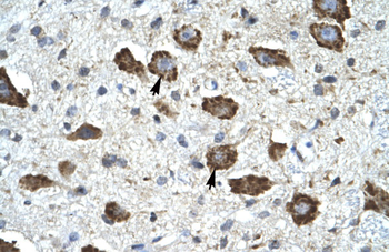 KCNIP2 Rabbit Polyclonal Antibody