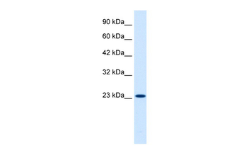 KCNIP2 Rabbit Polyclonal Antibody