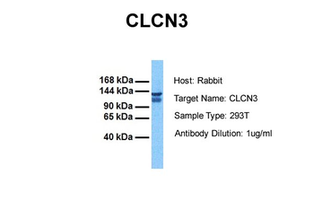 CLCN3 Rabbit Polyclonal Antibody