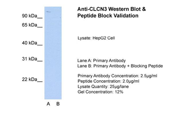 CLCN3 Rabbit Polyclonal Antibody