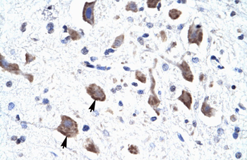 CLCN3 Rabbit Polyclonal Antibody