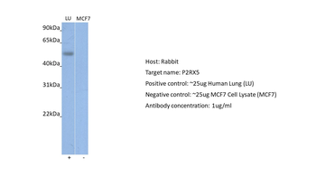 P2RX5 Rabbit Polyclonal Antibody