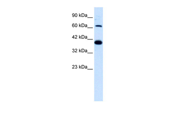 GRIK2 Rabbit Polyclonal Antibody