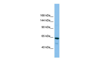 GRIK2 Rabbit Polyclonal Antibody