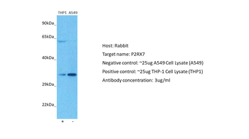 P2RX7 Rabbit Polyclonal Antibody
