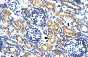 P2RX7 Rabbit Polyclonal Antibody