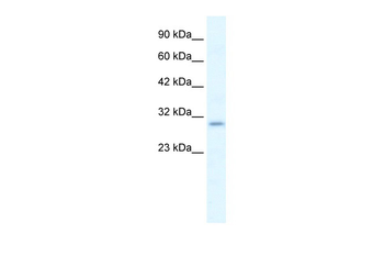 P2RX7 Rabbit Polyclonal Antibody