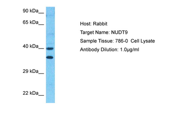NUDT9 Rabbit Polyclonal Antibody