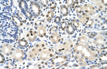 CACNB1 Rabbit Polyclonal Antibody