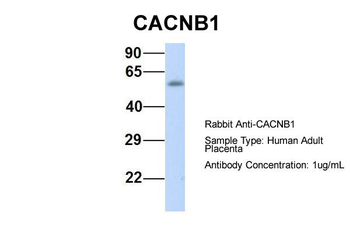 CACNB1 Rabbit Polyclonal Antibody