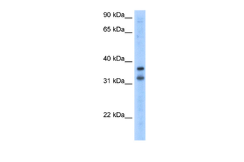 KCNRG Rabbit Polyclonal Antibody