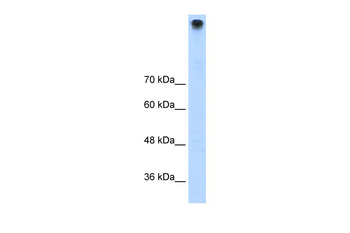 TRPM3 Rabbit Polyclonal Antibody