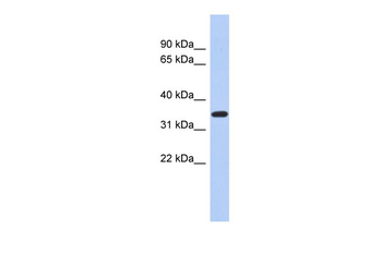 KLF6 Rabbit Polyclonal Antibody