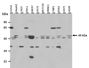 FOXJ1 Rabbit Polyclonal Antibody
