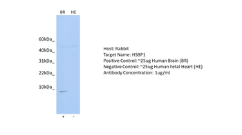 HSBP1 Rabbit Polyclonal Antibody