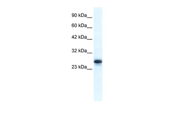 HMGB1 Rabbit Polyclonal Antibody