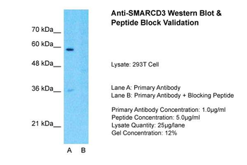 SMARCD3 Rabbit Polyclonal Antibody