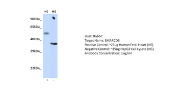 SMARCD3 Rabbit Polyclonal Antibody
