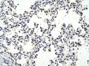SMARCD3 Rabbit Polyclonal Antibody