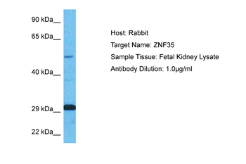 ZNF35 Rabbit Polyclonal Antibody