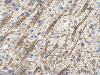 ZNF74 Rabbit Polyclonal Antibody