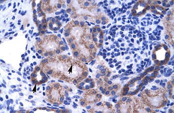 ZNF84 Rabbit Polyclonal Antibody