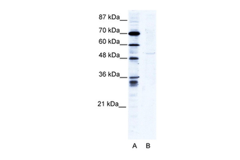 ZNF134 Rabbit Polyclonal Antibody