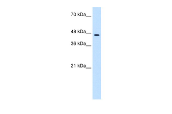 ZNF213 Rabbit Polyclonal Antibody