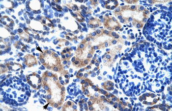 ONECUT2 Rabbit Polyclonal Antibody