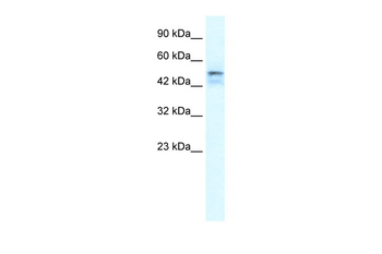 ONECUT2 Rabbit Polyclonal Antibody