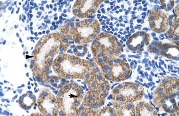 TBPL1 Rabbit Polyclonal Antibody