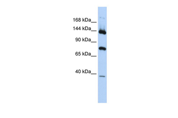 PLA2G4B Rabbit Polyclonal Antibody