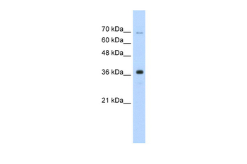 ZRANB2 Rabbit Polyclonal Antibody