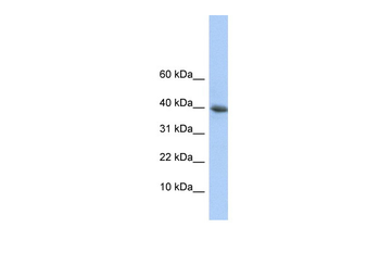 POLR2I Rabbit Polyclonal Antibody