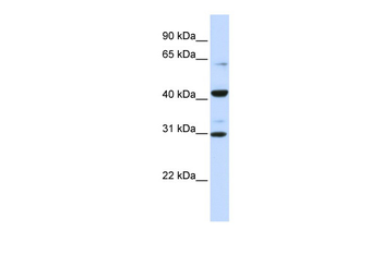 ZNF193 Rabbit Polyclonal Antibody