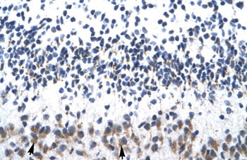 ZNF266 Rabbit Polyclonal Antibody