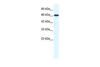 ZNF266 Rabbit Polyclonal Antibody