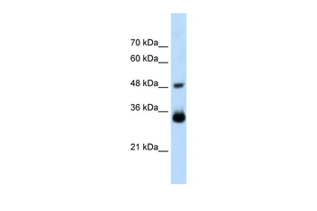 HOXC9 Rabbit Polyclonal Antibody