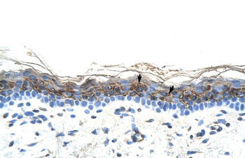 ZIC2 Rabbit Polyclonal Antibody