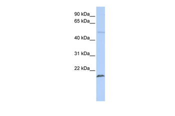 ZNF79 Rabbit Polyclonal Antibody