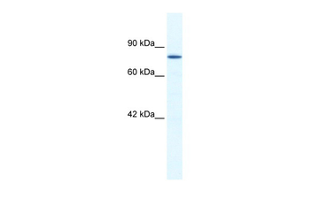 ZNF214 Rabbit Polyclonal Antibody