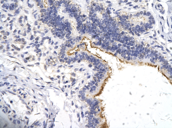 ZNF180 Rabbit Polyclonal Antibody