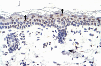 ZNF223 Rabbit Polyclonal Antibody